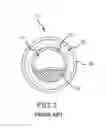 Fig. 04 - Arch shaped laser catheter