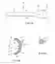 Fig. 06 - Arch shaped laser catheter