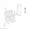Fig. 22 - Robotic system and method for reorienting a surgical instrument moving along a tool path