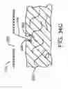 Fig. 49 - Robotic system and method for reorienting a surgical instrument moving along a tool path
