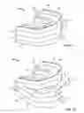 Fig. 03 - Methods and materials for oral stenting