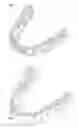 Fig. 01 - Tabbed dental appliance