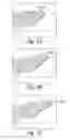 Fig. 04 - Tabbed dental appliance