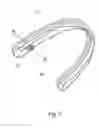 Fig. 02 - ADHESION PADS FOR FASTENING AN ORTHODONTIC ALIGNER