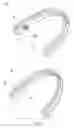 Fig. 03 - ADHESION PADS FOR FASTENING AN ORTHODONTIC ALIGNER