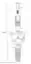Fig. 02 - Method and apparatus for recording spatial gingival soft tissue relationship to implant placement within alveolar bone for immediate-implant placement