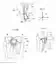 Fig. 06 - Method and apparatus for recording spatial gingival soft tissue relationship to implant placement within alveolar bone for immediate-implant placement