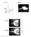 Fig. 04 - METHOD AND APPARATUS FOR UPPER AND LOWER TOOTH ROW THREE-DIMENSIONAL SIMULATION DISPLAY