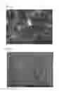 Fig. 04 - NANOCOMPOSITES FOR SOFT TISSUE REPAIR AND REPLACEMENT