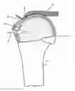 Fig. 01 - Arthroscopic Method and Apparatus for Rotator Cuff Repair