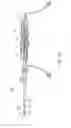 Fig. 03 - Profile altering tip for a delivery system