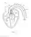 Fig. 04 - Profile altering tip for a delivery system