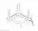Fig. 01 - Prosthetic heart valve