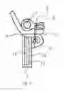 Fig. 05 - Prosthetic heart valve