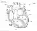 Fig. 01 - Reinforced Prosthetic Tissue Valves