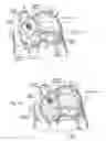 Fig. 10 - Devices, systems, and methods for reshaping a heart valve annulus, including the use of a bridge implant having an adjustable bridge stop
