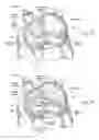 Fig. 15 - Devices, systems, and methods for reshaping a heart valve annulus, including the use of a bridge implant having an adjustable bridge stop