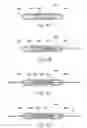 Fig. 19 - Devices, systems, and methods for reshaping a heart valve annulus, including the use of a bridge implant having an adjustable bridge stop