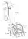 Fig. 20 - Devices, systems, and methods for reshaping a heart valve annulus, including the use of a bridge implant having an adjustable bridge stop