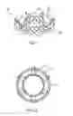 Fig. 02 - Valve prosthesis and method for delivery