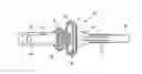 Fig. 01 - Percutaneous implant