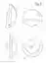 Fig. 07 - Total Shoulder Arthroplasty Prosthesis