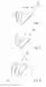 Fig. 02 - Shoulder prosthesis and components thereof