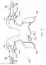 Fig. 04 - Prosthesis for the replacement of a posterior element of a vertebra