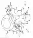 Fig. 06 - Prosthesis for the replacement of a posterior element of a vertebra