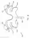 Fig. 09 - Prosthesis for the replacement of a posterior element of a vertebra