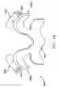 Fig. 19 - Prosthesis for the replacement of a posterior element of a vertebra