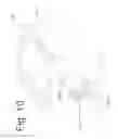 Fig. 11 - Bone fixation and fusion device