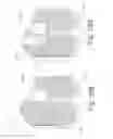 Fig. 24 - Bone fixation and fusion device