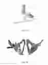 Fig. 06 - APPARATUS AND METHOD FOR POSITIONING OF ACETABULAR COMPONENTS DURING HIP ARTHROPLASTY PROCEDURES