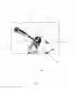 Fig. 08 - APPARATUS AND METHOD FOR POSITIONING OF ACETABULAR COMPONENTS DURING HIP ARTHROPLASTY PROCEDURES