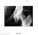Fig. 22 - APPARATUS AND METHOD FOR POSITIONING OF ACETABULAR COMPONENTS DURING HIP ARTHROPLASTY PROCEDURES