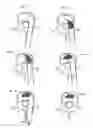 Fig. 08 - END PLATE SLIDER/DISTRACTOR FOR POSTERIOR INTERVERTEBRAL DEVICE AND METHOD