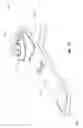 Fig. 32 - Adjustable length prosthetic foot