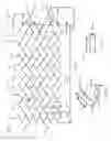 Fig. 02 - Vascular stent with improved vessel wall apposition