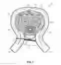 Fig. 02 - Erectile dysfunction band