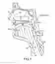 Fig. 02 - Buccal bioadhesive strip and method of treating snoring and sleep apnea