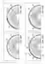 Fig. 22 - Delivering ocular implants into the eye