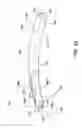 Fig. 35 - Delivering ocular implants into the eye