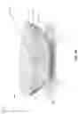 Fig. 35 - APERTURE WIDENING PROSTHESIS INCLUDING SPLINE SURFACE TOPOGRAPHY AND METHODS OF MAKING THE SAME