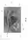 Fig. 43 - APERTURE WIDENING PROSTHESIS INCLUDING SPLINE SURFACE TOPOGRAPHY AND METHODS OF MAKING THE SAME