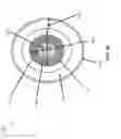 Fig. 45 - APERTURE WIDENING PROSTHESIS INCLUDING SPLINE SURFACE TOPOGRAPHY AND METHODS OF MAKING THE SAME