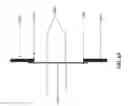 Fig. 72 - APERTURE WIDENING PROSTHESIS INCLUDING SPLINE SURFACE TOPOGRAPHY AND METHODS OF MAKING THE SAME
