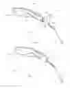 Fig. 02 - Tympanostomy tube and insertion device