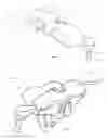 Fig. 08 - Tympanostomy tube and insertion device
