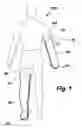 Fig. 02 - PROTECTIVE CAST COVER